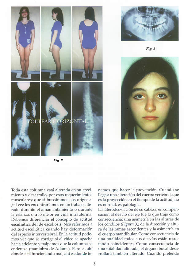 Dr. Guillermo F. Godoy Esteves - Por qu Ortopedia Funcional? - Pgina 03