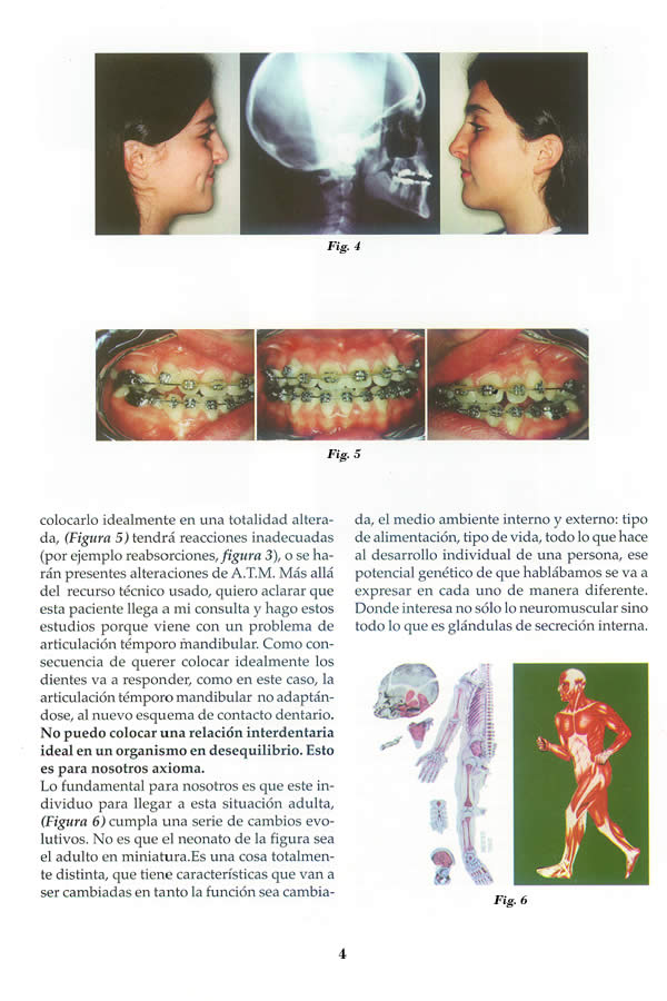 Dr. Guillermo F. Godoy Esteves - Por qu Ortopedia Funcional? - Pgina 04