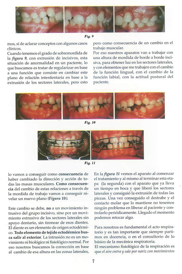Dr. Guillermo F. Godoy Esteves - Por qu Ortopedia Funcional? - Pgina 07