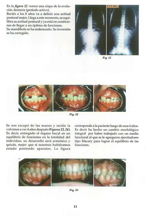 Dr. Guillermo F. Godoy Esteves - Por qu Ortopedia Funcional? - Pgina 11