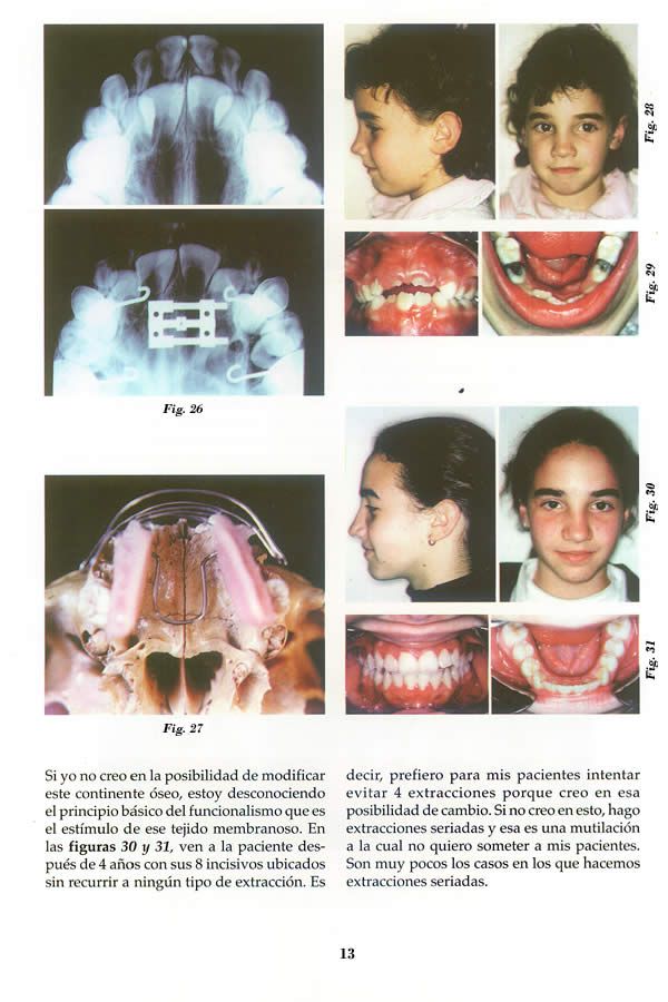 Dr. Guillermo F. Godoy Esteves - Por qu Ortopedia Funcional? - Pgina 13