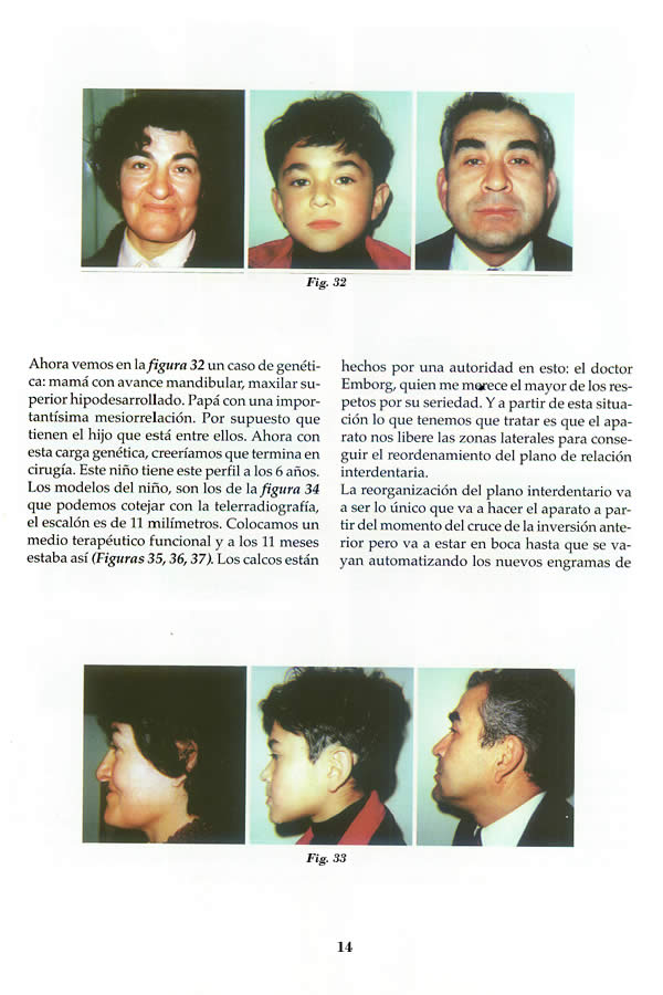Dr. Guillermo F. Godoy Esteves - Por qu Ortopedia Funcional? - Pgina 14