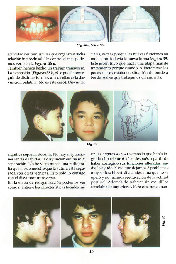 Dr. Guillermo F. Godoy Esteves - Por qu Ortopedia Funcional? - Pgina 16